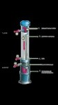 Ultrafiltration